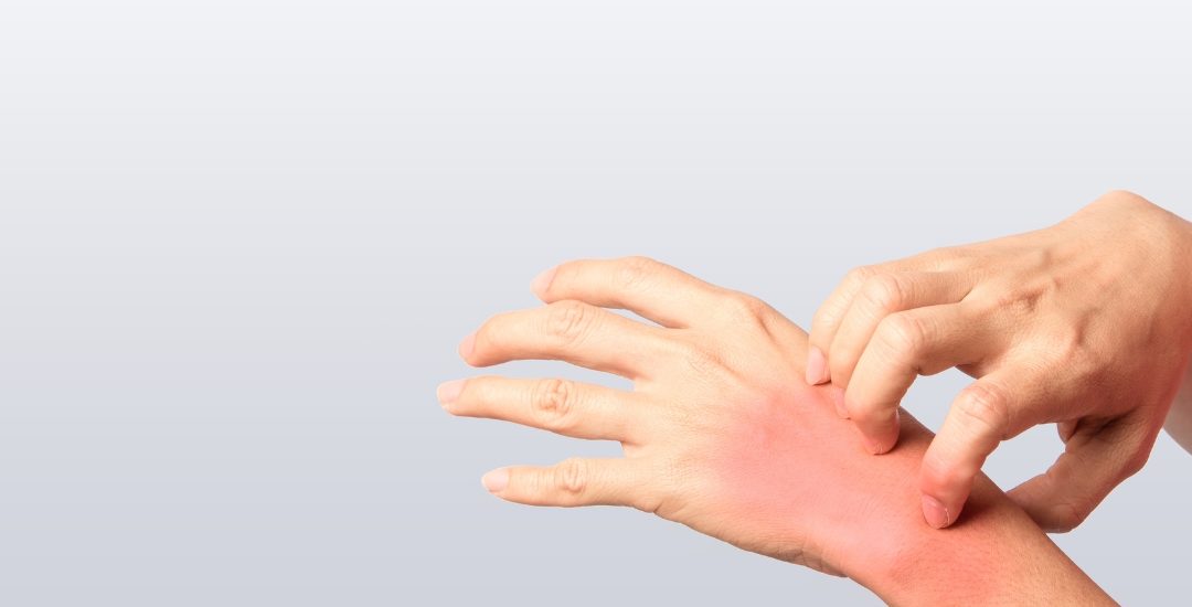 Allergy Relief: Best OTC Allergy Medicines