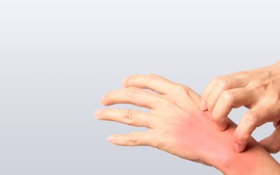 Allergy Relief: Best OTC Allergy Medicines